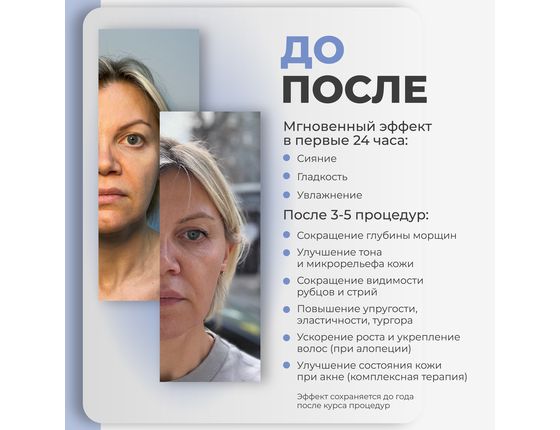 AGT Bio Nucleo 20 - Биорепарирующий комплекс