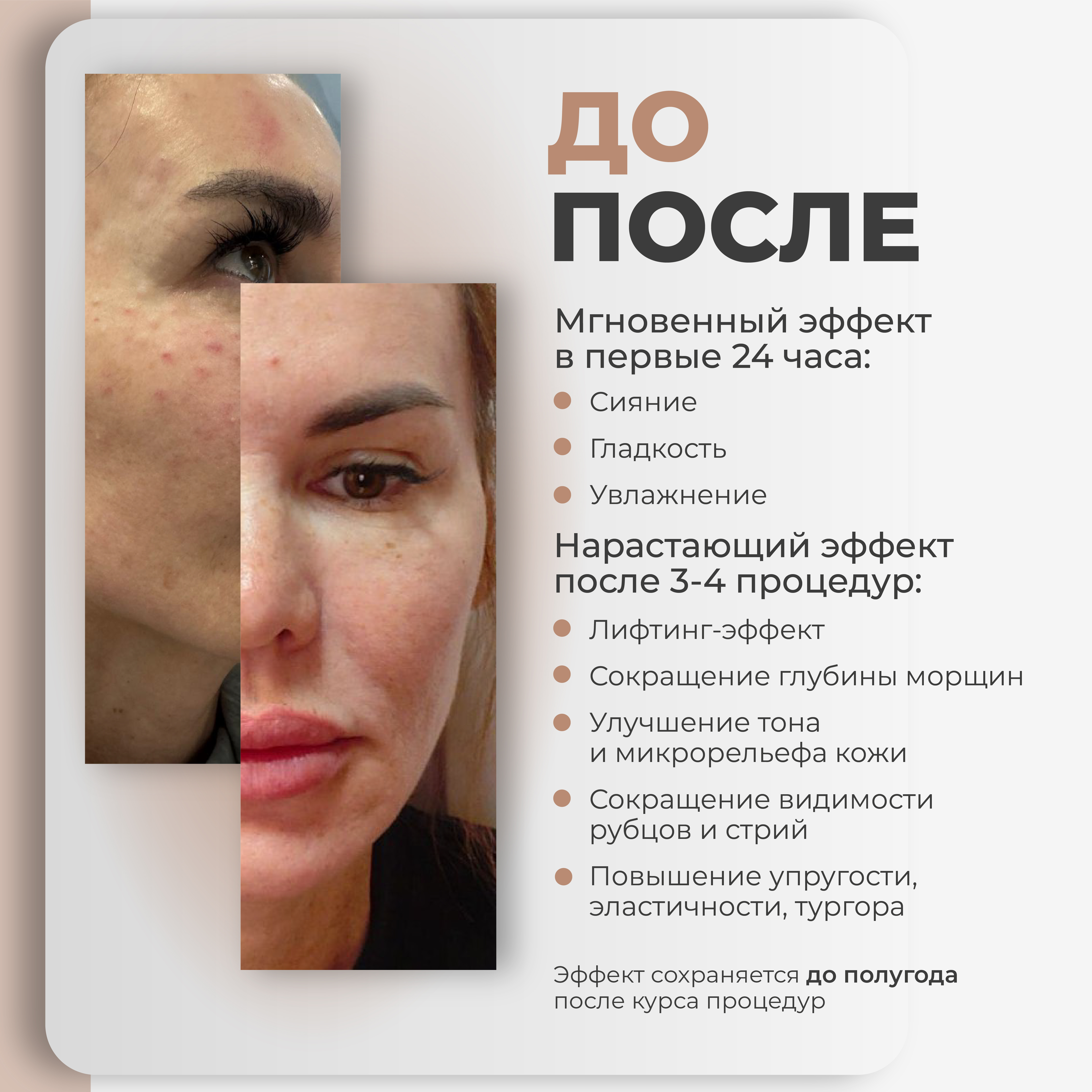 AGT Bio Cologenum Plus - Биорепарант с RHLC и PDRN