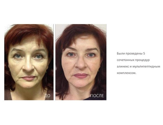 Мультипептидный комплекс VEC