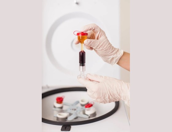 Центрифуга Liston C2201