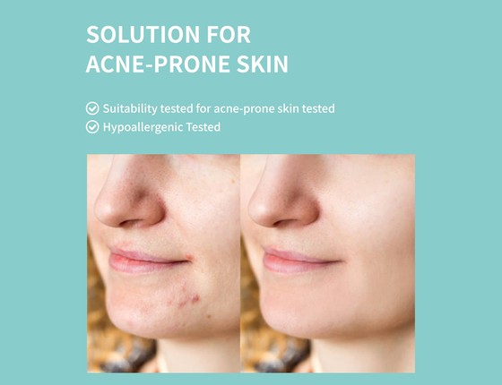 Капсульная сыворотка VITAACNAL TX против акне (VITAACNAL TX Capsule Serum) Капсульная сыворотка VITAACNAL TX против акне (VITAACNAL TX Capsule Serum)