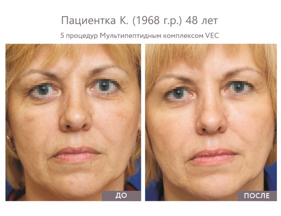 Мультипептидный комплекс VEC