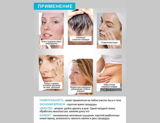 Микронидлинг